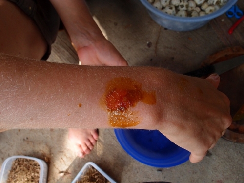 лечение куркумой, лечение ожога свежим соком из корня куркумы | Natural analgetic remedy to cure external wounds, treatment of burn with turmeric root fresh juice